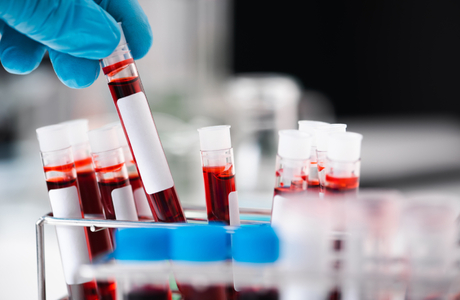 Ряд московских лабораторий столкнулся с нехваткой реагентов для ковидных анализов