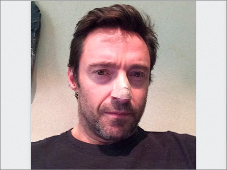 Хью Джекман. Фото: instagram.com/thehughjackman